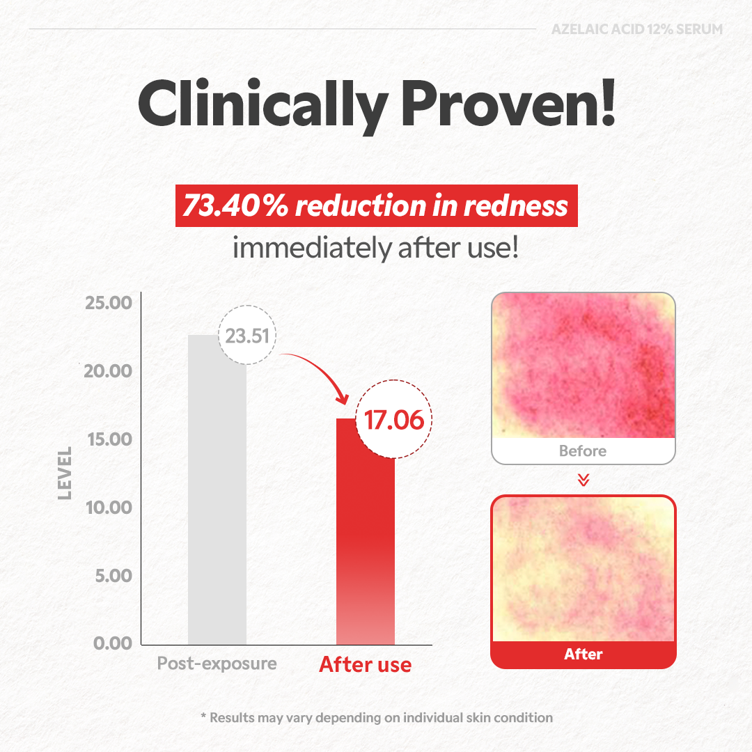 Azelaic Acid 12% Serum